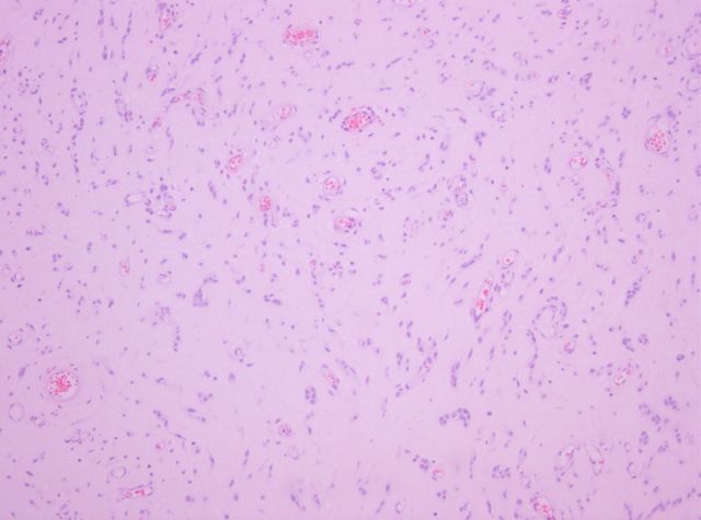 Hematoxilina-Eosina x100 - <div style=